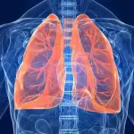 Tumore al polmone: un nuovo sistema per la diagnosi precoce tutto italiano